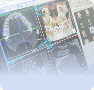 歯科用CT