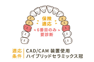 適応条件：CAD/CAM装置仕様 ハイブリッドセラミック冠