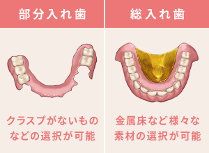 部分入れ歯：クラスプがないものなどの選択が可能、総入れ歯：金属床など様々な素材の選択が可能